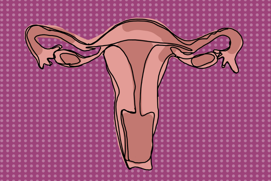 A uterus drawn against a pink striped background.