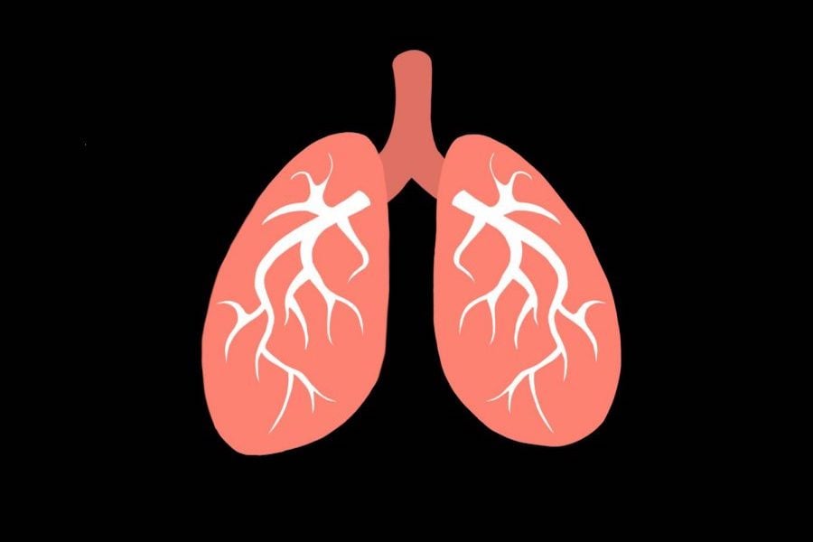 NU researchers identify genome to help treat small-cell lung cancer